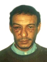 Lumumba Mohseni suite à une agression en 2001